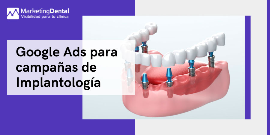 Google Ads Implantes dentales